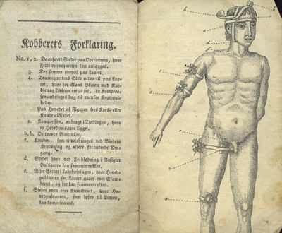 Kort Underretning om Feldtturnequetten og dens Anvendelse for at standse stærke Forblødninger ved Saar. For Militaire af (...). Med et Kobber. Andet Oplag. (photo 3)