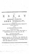 An Essay on the Malignant, Ulcerated Sore Throat
