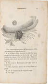 View Image 4 of 5 for EXPERIMENTS AND OBSERVATIONS ON THE GASTRIC JUICE, AND THE PHYSIOLOGY OF DIGESTION Inventory #914