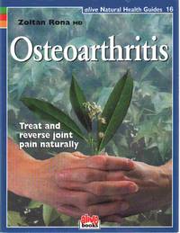 cover of OSTEOARTHRITIS (ALIVE NATURAL HEALTH GUIDES)