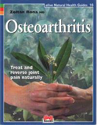 OSTEOARTHRITIS (ALIVE NATURAL HEALTH GUIDES)