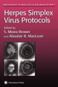 Herpes Simplex Virus Protocols