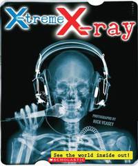 X-Treme X-Ray : See the World Inside Out!