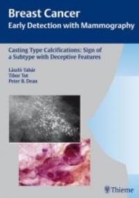 Casting-Type Calcifications Sign of a Subtype with Deceptive Features Breast Cancer Early...