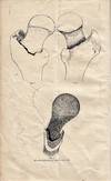 The True Neck of the Femur: its structure and pathology