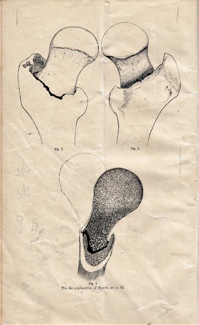 The True Neck of the Femur: its structure and pathology