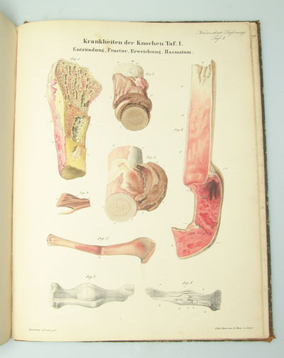 Atlas der Pathologischen Anatomie oder Bildliche…