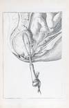 A Set of Anatomical Tables, with Explanations, and an Abridgement, of the Practice of Midwifery