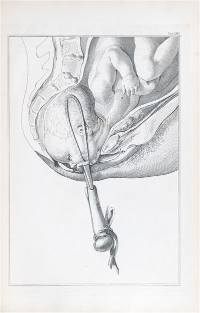 A Set of Anatomical Tables, with Explanations, and an Abridgement, of the Practice of Midwifery
