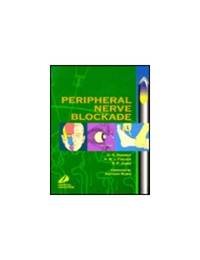 Peripheral Nerve Blockade
