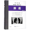 Lung cancer (original version 4)(Chinese Edition)