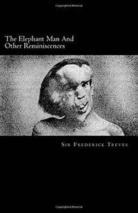 Treves and the Elephant Man