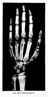 Atlas of Skeletal Maturation