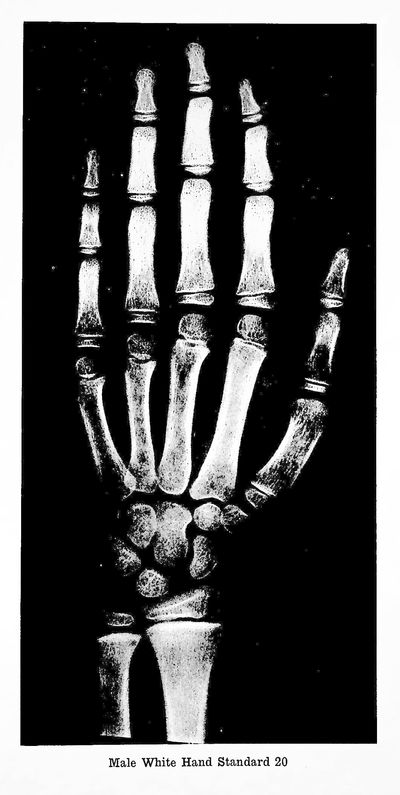 Atlas of Skeletal Maturation