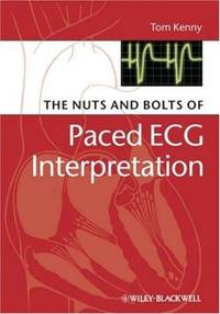 The Nuts and bolts of Paced ECG Interpretation