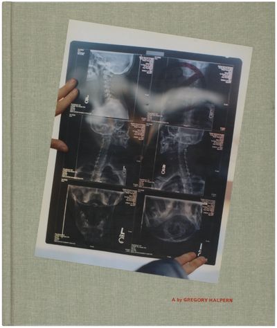 A (Signed)