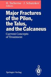 Major Fractures of the Pilon, the Talus, and the Calcaneus : Current Concepts of Treatment