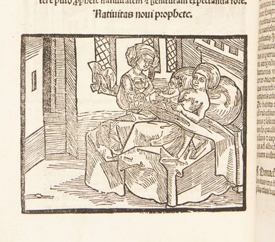 [Prognosticatio]. Hec practice narrat...; (photo 11)