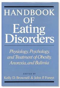 Handbook Of Eating Disorders: Physiology, Psychology, and Treatment of Obesity, Anorexia, and Bulimia