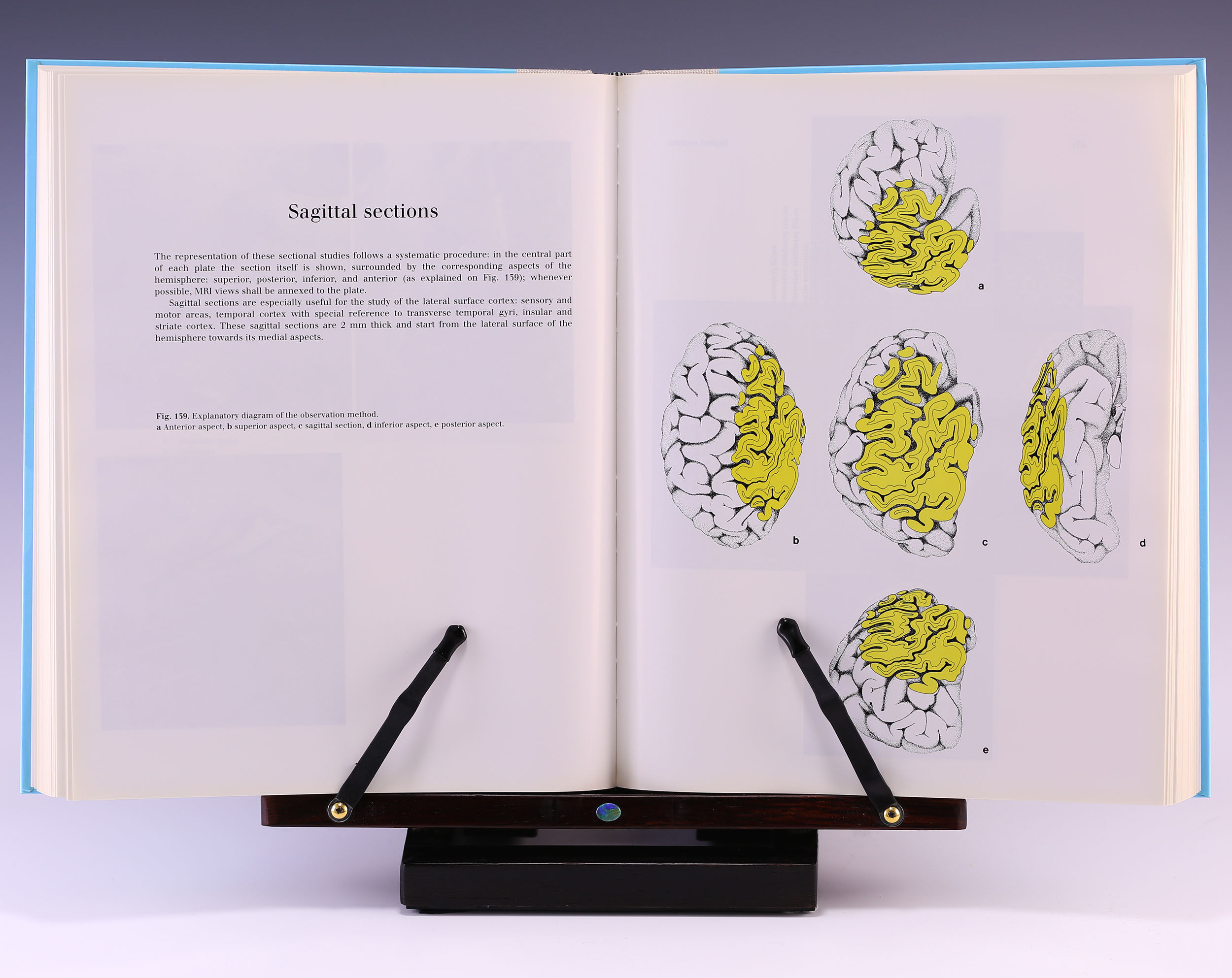 The Human Brain: Surface, Three-Dimensional Sectional Anatomy with 