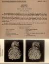 View Image 2 of 5 for Stereoscopic Studies of Anatomy; Prepared under authority of the University of Edinburgh [Section VI... Inventory #13115