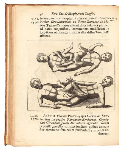 Fortunius Licetus De Monstris. Ex...; (photo 8)