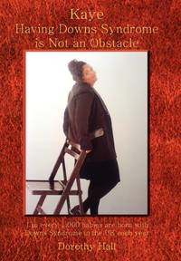 Kaye Having Downs Syndrome Is Not an Obstacle: 1 in Every 1.000 Babies Are Born with Downs...