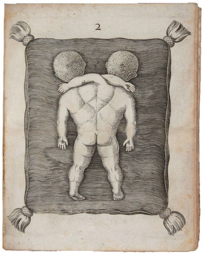 Specimina Anatomica, cum clarriss. Doctissimorumque Virorum Epistolis aliquot & Testimoniis