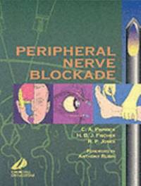 Peripheral Nerve Blockade