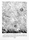The Renal Lesion in Bright's Disease