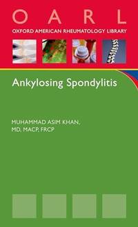 Ankylosing Spondylitis