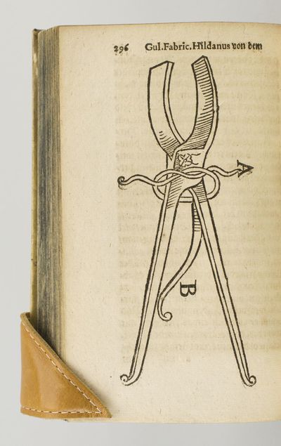 NEW FELDT ARTZNY BUCH VON KRANCKHEITEN UND SCHÄDEN, SO IN KRIEGEN DEN WUNDARTZTEN GEMEINLICH FÜRFALLEN. [with] DE COMBUSTIONIBUS, QUAE OLEO ET AQUA FERVIDA, FERRO CANDENTE, PULVERE TORMENTARIO, FULMINE, & QUAVIS ALIA MATERIA IGNITA FIUNT LIBELLUS. [with] DE VULNERE QUODAM GRAVISSIMO & PERICULOSO, ICTU SCLOPETI INFLICTO, OBSERVATIO ET CURATIO SINGULARIS. [with] DE DYSENTERIA, HOC EST, CRUENTO ALVI FLUORE, LIBER UNUS