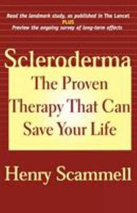 Scleroderma : The Proven Therapy That Can Save Your Life