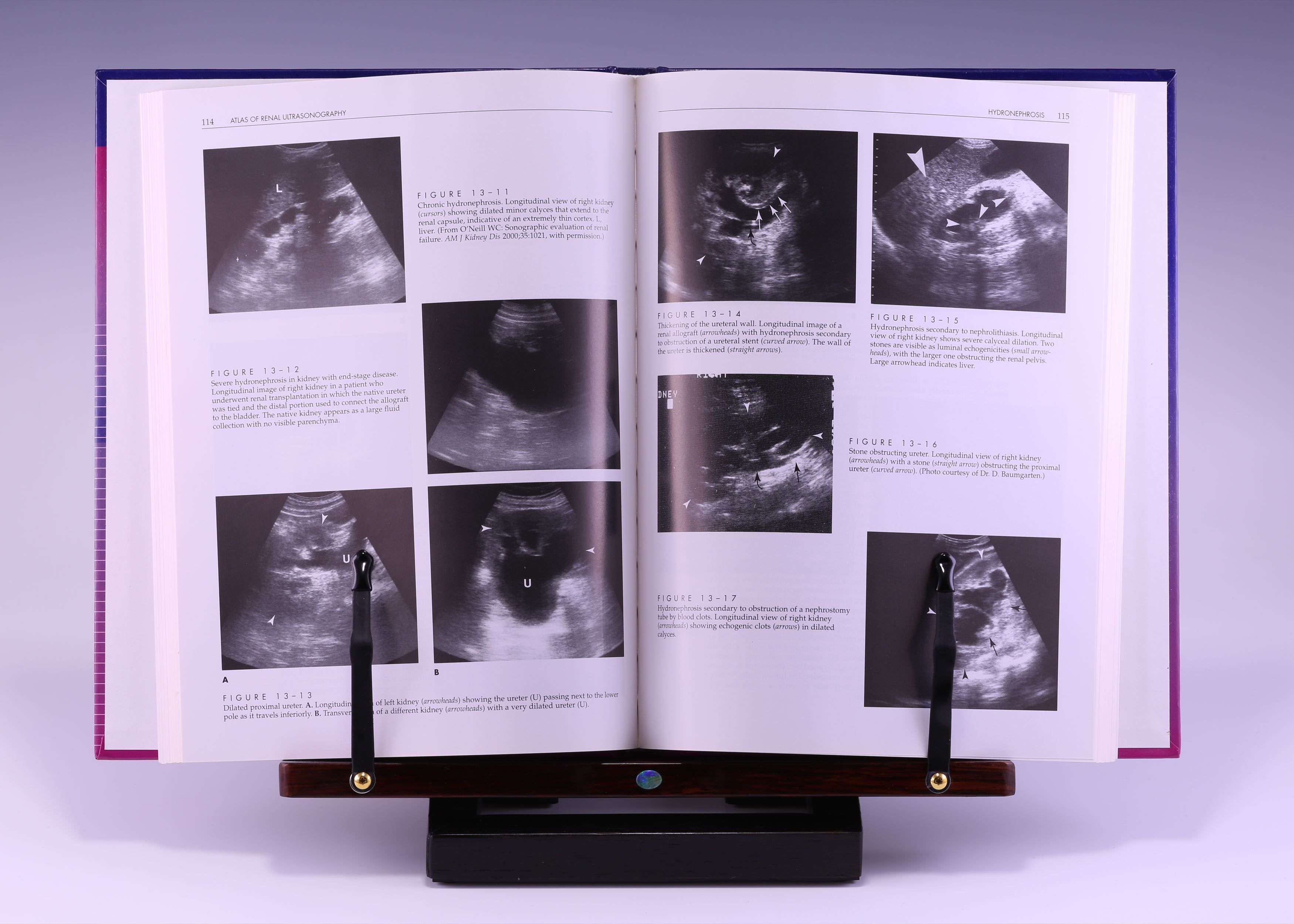 Atlas of Renal Ultrasonography by W. Charles O'Neill MD
