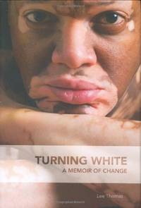 Turning White: A Memoir of Change by Thomas, Lee