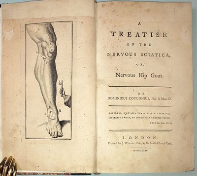 A treatise on the nervous sciatica, or nervous hip-gout