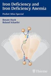 Iron Deficiency and Iron Deficiency Anemia. Pocket Atlas Special von Renate Huch (Autor), Roland...