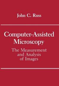 Computer-Assisted Microscopy : The Measurement and Analysis of Images