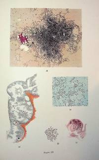 The Etiology and Pathology of Typhus. Being the Main Report of the Typhus Research commission of the League of Red Cross Societies to Poland