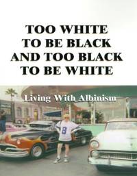 Too White to Be Black and Too Black to Be White: Living with Albinism