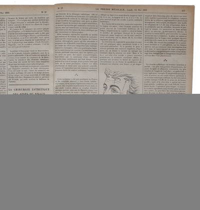 La Chirurgie Esthétique des Rides du Visage. [In: La Presse Médicale. No 27. Lundi, 12 Mai 1919]. - [FIRST PUBLISHED FACELIFT] (photo 2)