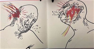 Balding v.s. Invisible.