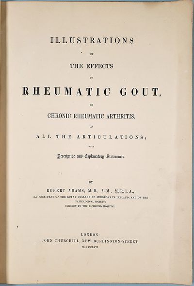 Illustrations of the effects of rheumatic gout. Atlas only