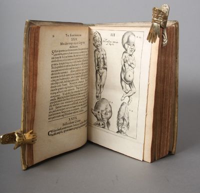 Acta Medica & Philosophica Hafniensia. Volume 1-5 (in four volumes). (photo 4)