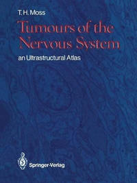 Tumours of the Nervous System: an Ultrastructural Atlas