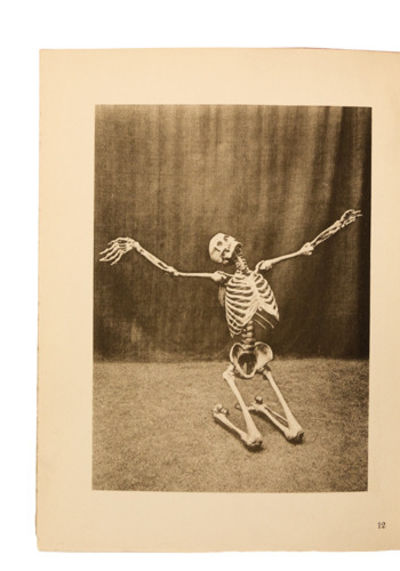 Ein Anatomischer Totentanz.