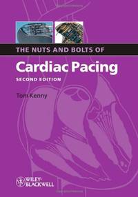 The Nuts and Bolts of Cardiac Pacing