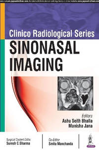 Clinico Radiological Series: Sinonasal Imaging
