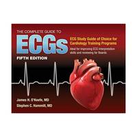 The Complete Guide to ECGS: ECG Study Guide of choice for Cardiology Training Programs; Ideal For...