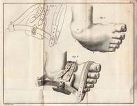 Mémoires de Physiologie et de Chirurgie-Pratique... I. De Penitiori ossium stractura Commentarius (par Scarpa), cum praefatione et notis pathologicis, ab editore. II. Des Pieds-bots et de la manière de corriger cette difformité congénitale.Par Scarpa. III. Des Luxations du Fémur en devant. Par Léveillé. IV. Considérations générales sur les Nécroses. Par Léveillé